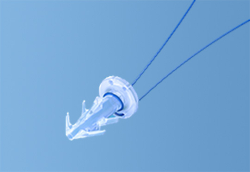 splentis008