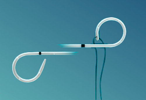 stent-ureteral003-1
